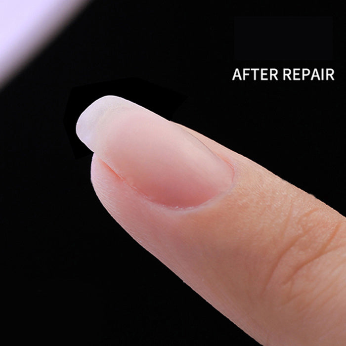Cracked Nail Repair Kit- 10 Pcs/Set